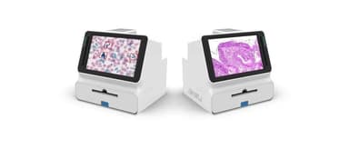 Over 50,000 Cases in a Single Day! Inside the Speed of Landing AI's Cervical Cancer Screening | Dalton Venture Family